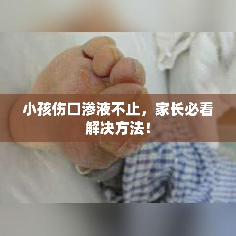 小孩伤口渗液不止，家长必看解决方法！